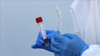 १५ प्रतिशत भन्दा बढीले घट्यो नेपालमा संक्रमणदर